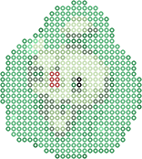 Duosion bead pattern